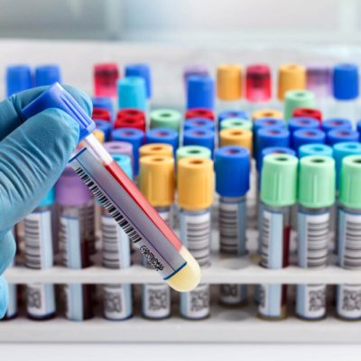 laboratory technician holding a blood tube test labeled with bar hand of a lab technician holding blood tube test and background a rack of color tubes with blood samples other patients / laboratory technician holding a blood tube test with code bar